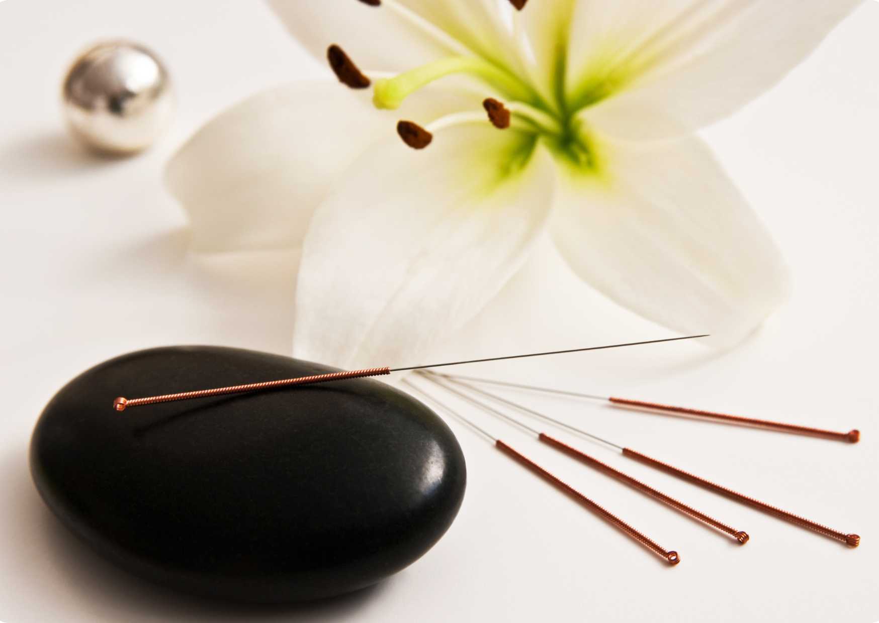 Fundamentals of Acupuncture